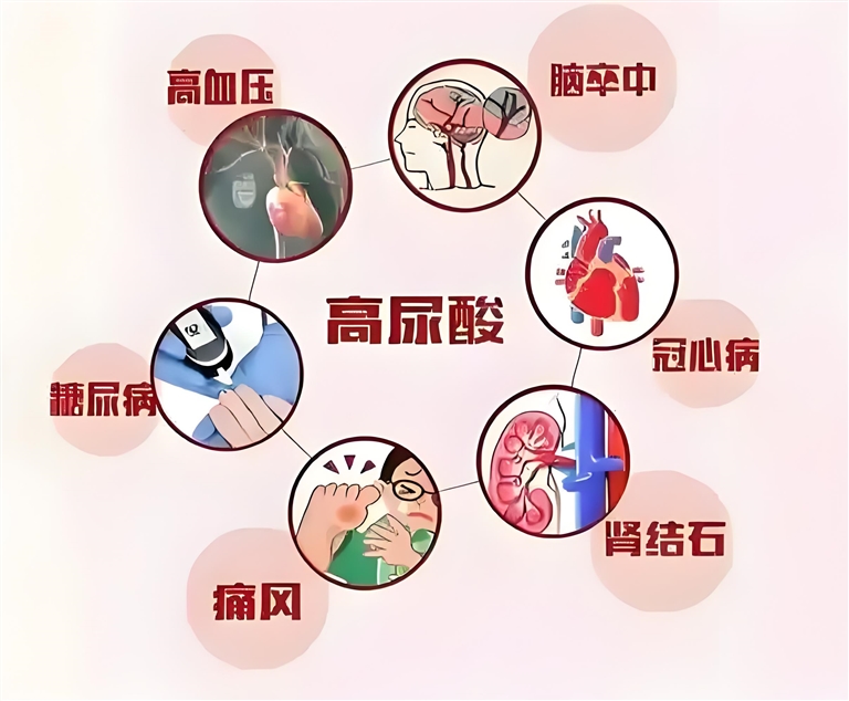 健康视点|节日聚餐，关注”三高“之外的“第四高”